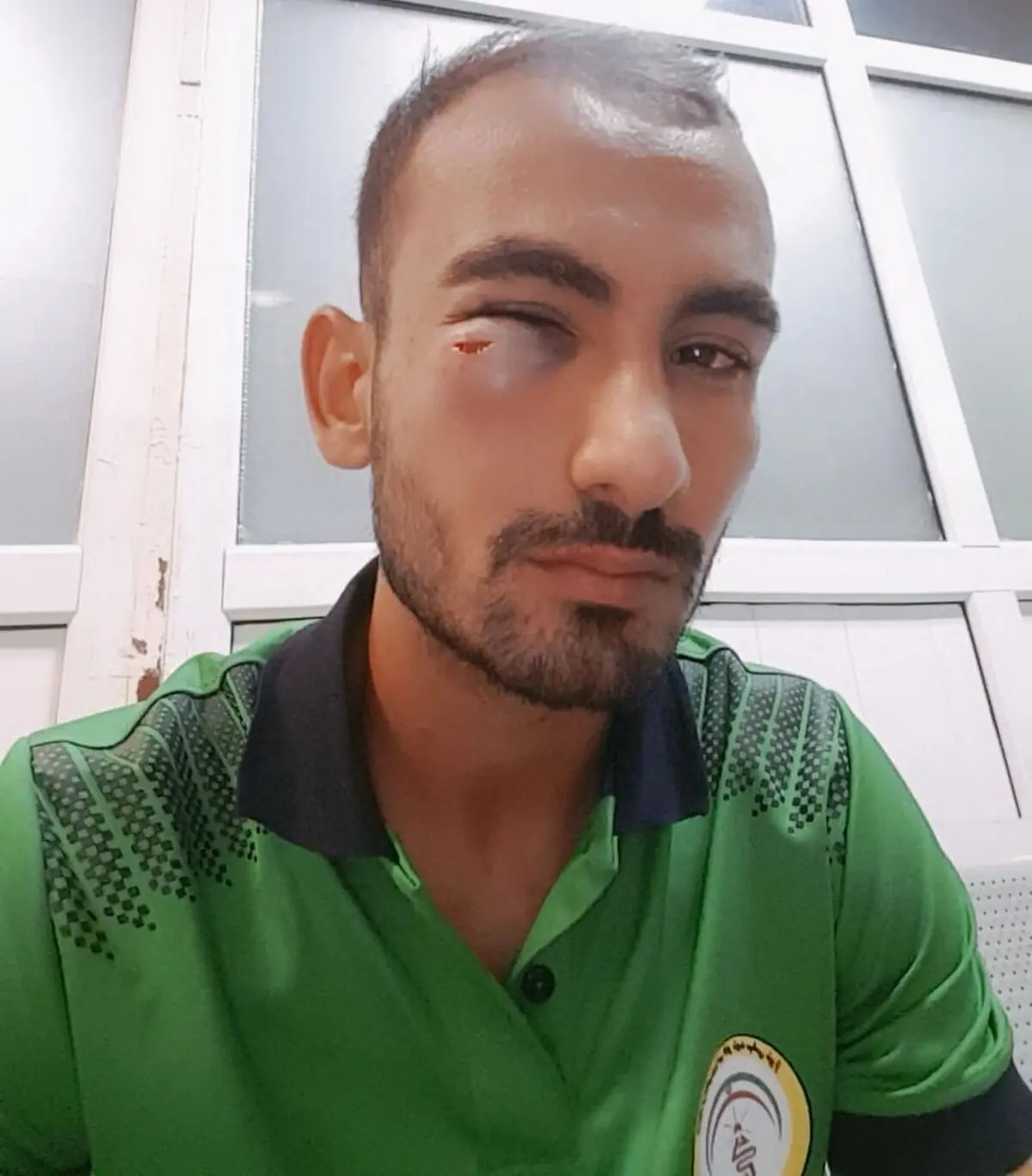 محمد امینی از بیمارستان مرخص شد