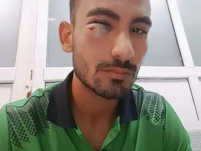 محمد امینی از بیمارستان مرخص شد