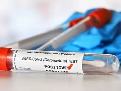 تست pcr کرونا با آزمایش آنلاین