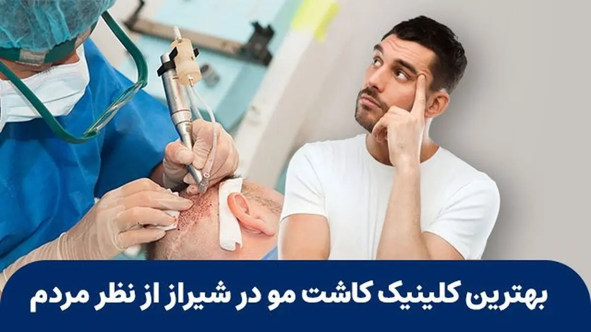 بهترین کلینیک کاشت مو در شیراز از نظر مردم