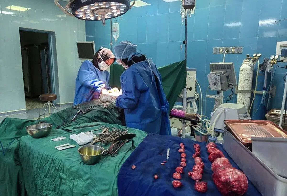 خارج کردن  ۳۰ توده میوم از بدن یک بیمار