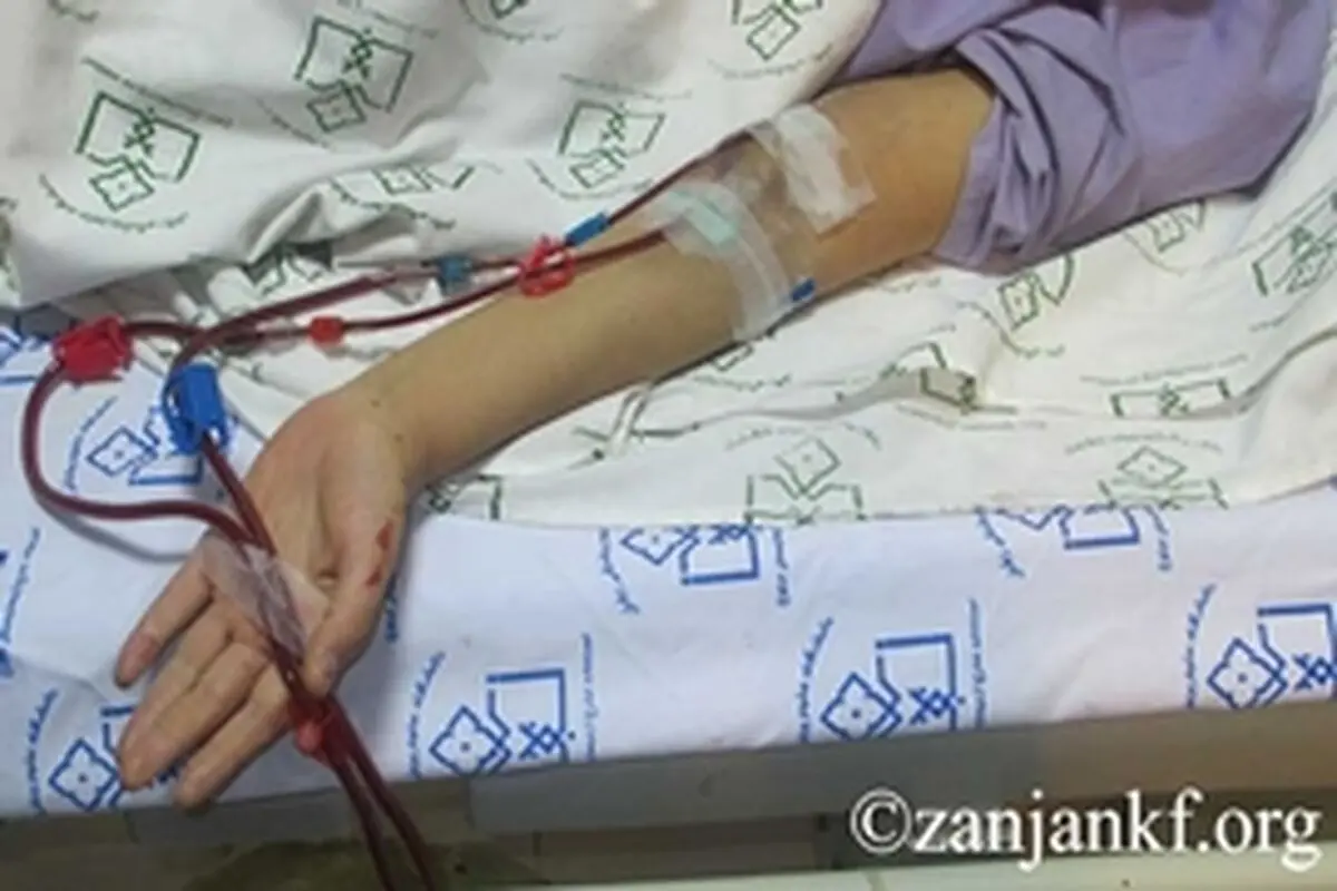 صرفه‌جویی ۱۷۰ میلیارد ریالی با خروج ۱۰۰۰ بیماران کلیوی زنجان از چرخه دیالیز