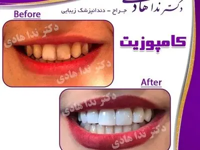 به زیبایی دندان های خود چقدر اهمیت می دهید !