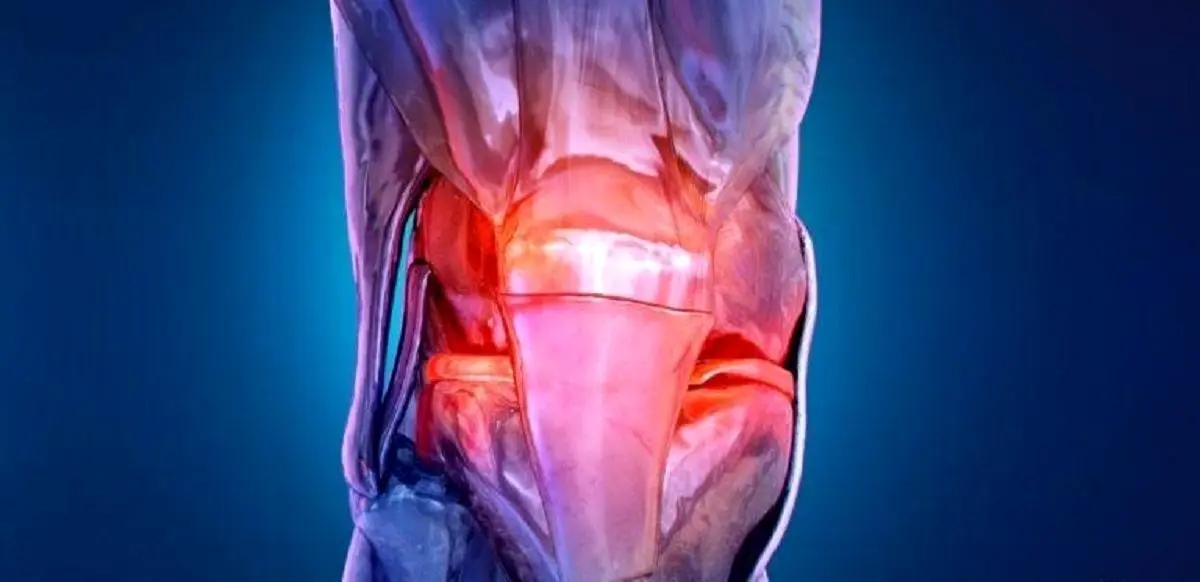 آرتروز دیگر بیماریِ سنین بالا نیست