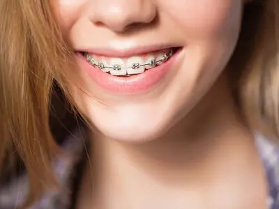 با ارتودنسی زیباتر لبخند بزنید + معرفی متخصص ارتودنسی