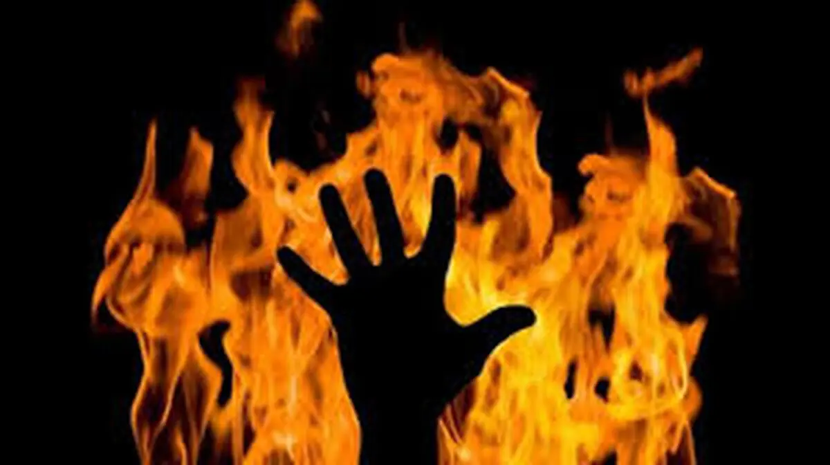 سوختگی 80 درصدی دختر 17 ساله دیشموکی/ بخشدار دیشموک: خودسوزی را تایید نمی‌کنم