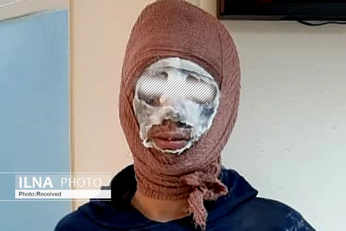 افزایش مصدومان حوادث آخرین چهارشنبه سال به ۷۵۱ نفر