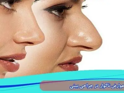 asdasd