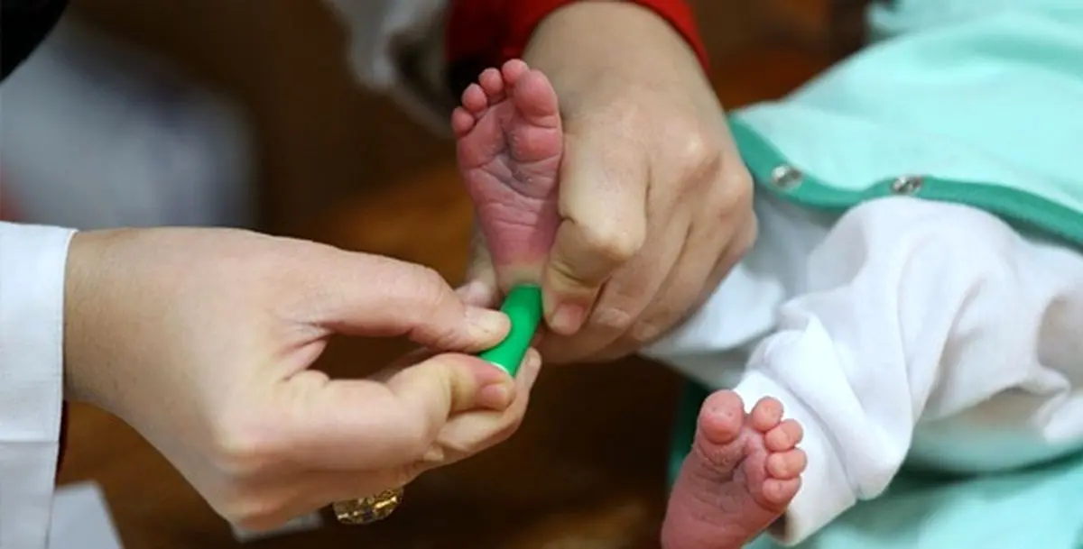 شناسایی ۳۱۱۷ نوزاد مبتلا به کمکاری تیروئید در فارس