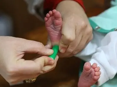 شناسایی ۳۱۱۷ نوزاد مبتلا به کم‌کاری تیروئید در فارس 