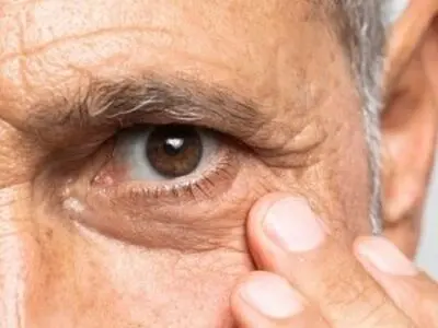 تاثیر ضعف دستگاه گوارش بر سلامت چشم ها