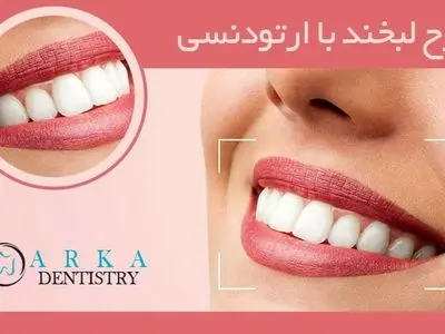 طرح لبخند با ارتودنسی
