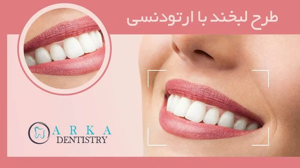 طرح لبخند با ارتودنسی