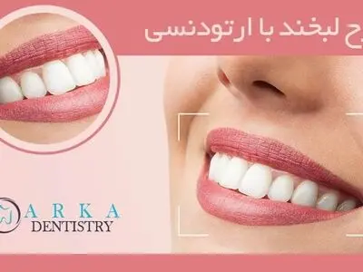 طرح لبخند با ارتودنسی