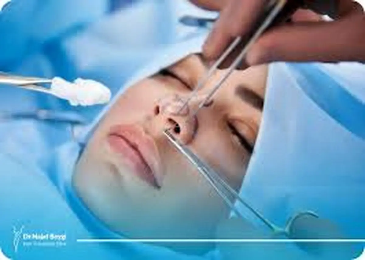  پیشگیری از افتادگی نوک بینی بعد از عمل