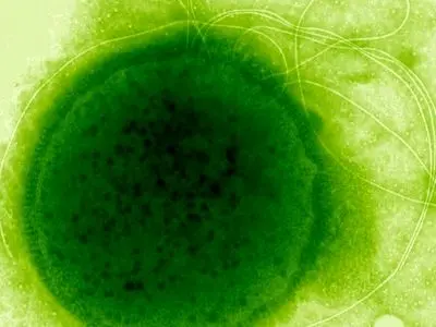 میکروبی که می‌تواند دزهای مرگبار تشعشع اتمی را تحمل کند