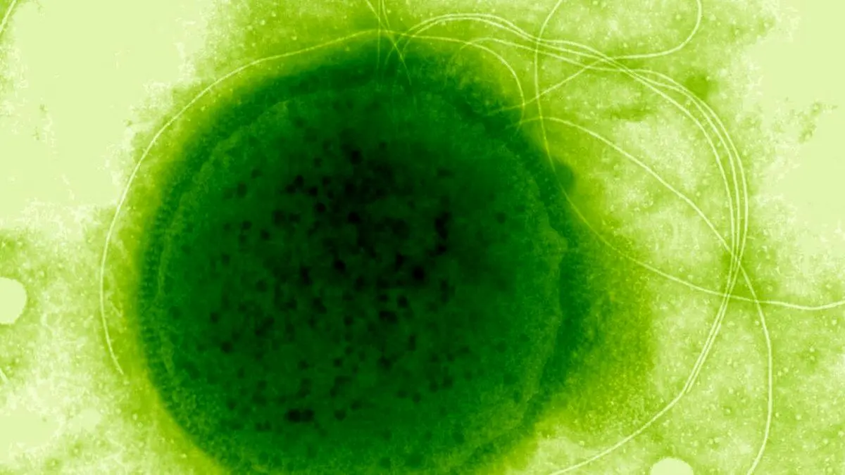 میکروبی که می‌تواند دزهای مرگبار تشعشع اتمی را تحمل کند