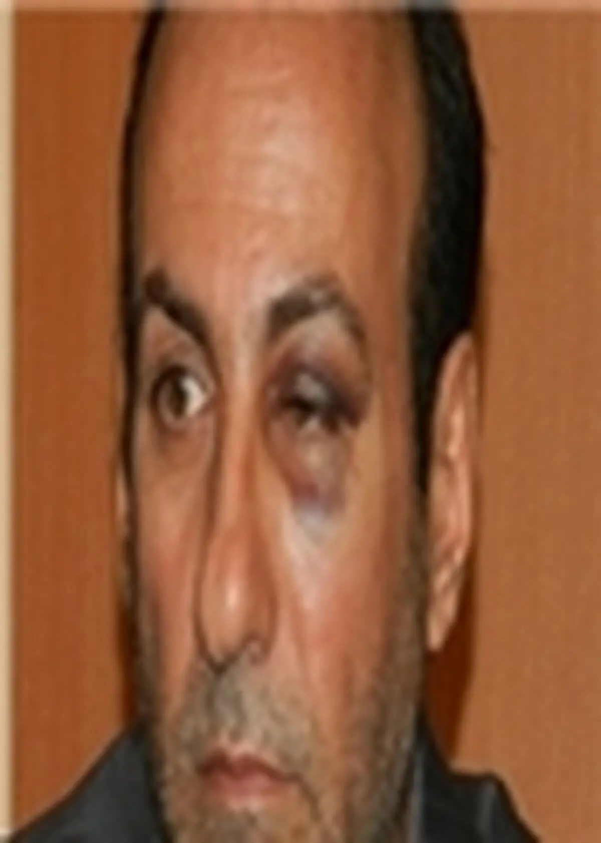 ضرب و شتم پزشک جراح در بیمارستان شهید بهشتی یاسوج
