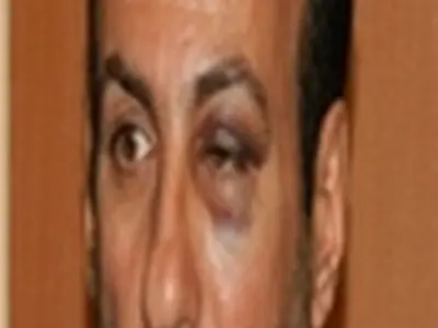 ضرب و شتم پزشک جراح در بیمارستان شهید بهشتی یاسوج