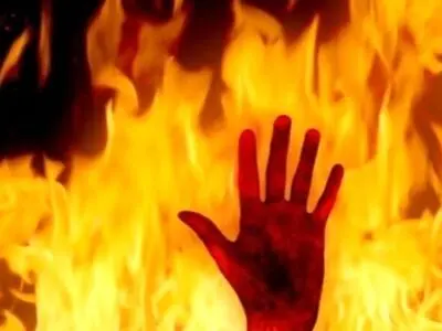 حمله به شهردار با بنزین و آتش زدن وی