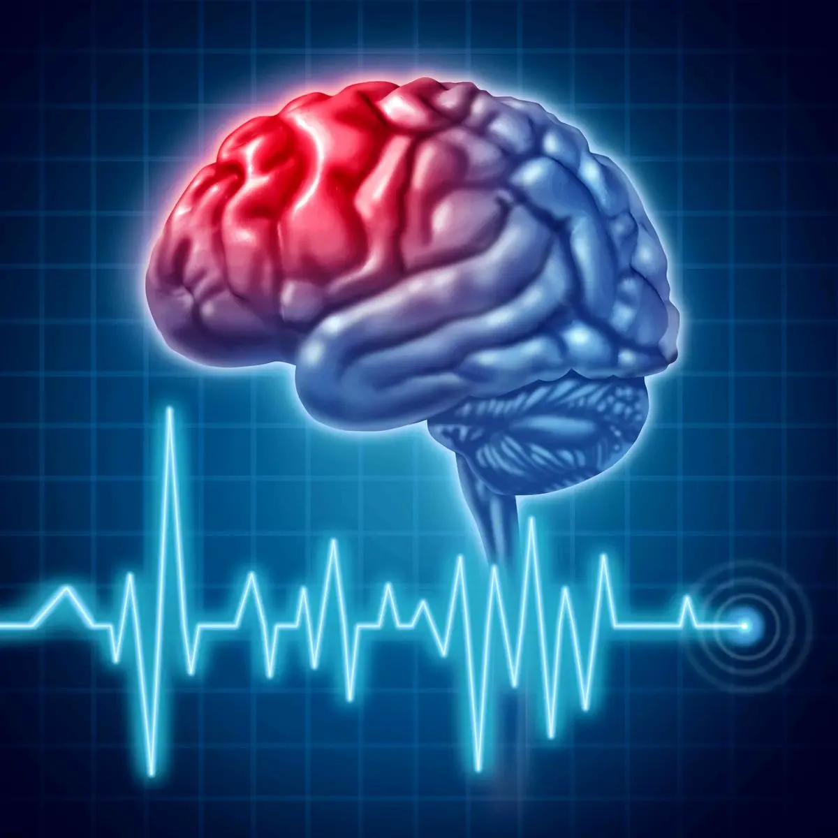 علائم سکته مغزی چیست؟+فیلم