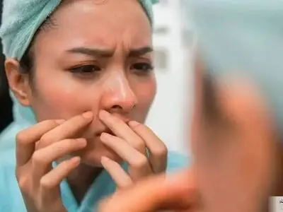 چرا در ۴۰ سالگی هنوز جوش می‌زنیم!