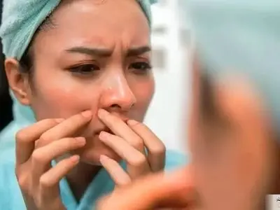 چرا در ۴۰ سالگی هنوز جوش می‌زنیم!