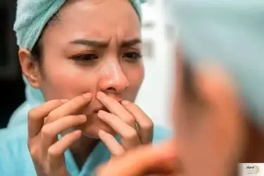 چرا در ۴۰ سالگی هنوز جوش می‌زنیم!