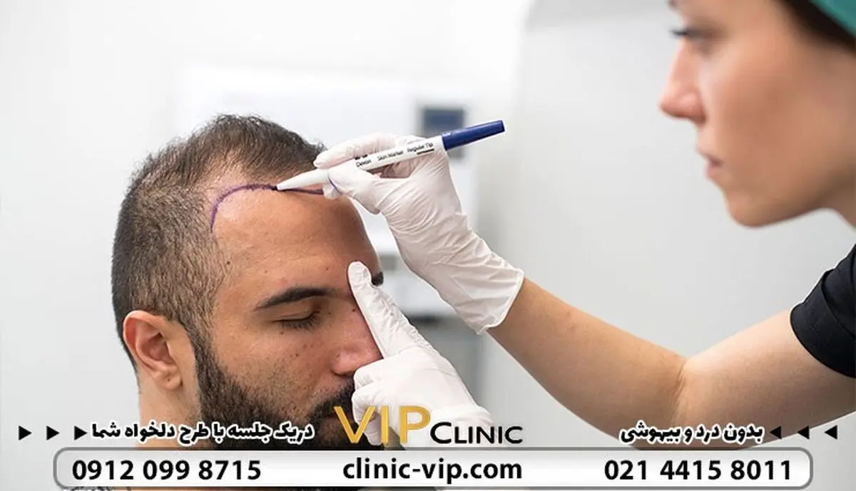 چگونه بهترین کلینیک کاشت مو در تهران را انتخاب کنید؟