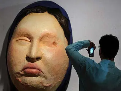 رنج‌های قربانی اسیدپاشی روی صحنه جان می‌گیرد