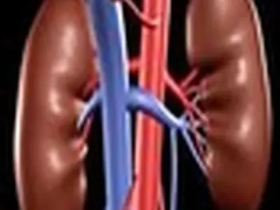 ۱۰نفر در زنجان تحت درمان دیالیز صفاقی است