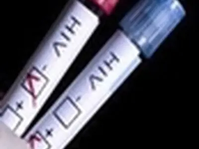 مراکز رایگان آزمایش ایدز