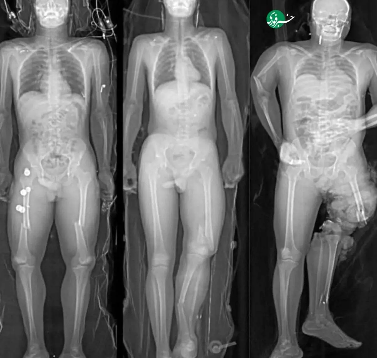 نشستن اشتباه در خودرو بدون کمربند، فاجعه‌ بار است!