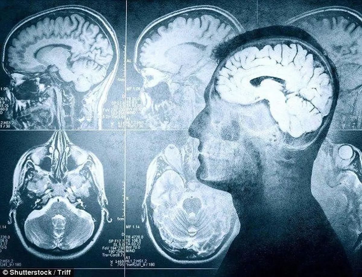 احتمال بازگشت به زندگی تا پنج دقیقه پس از مرگ