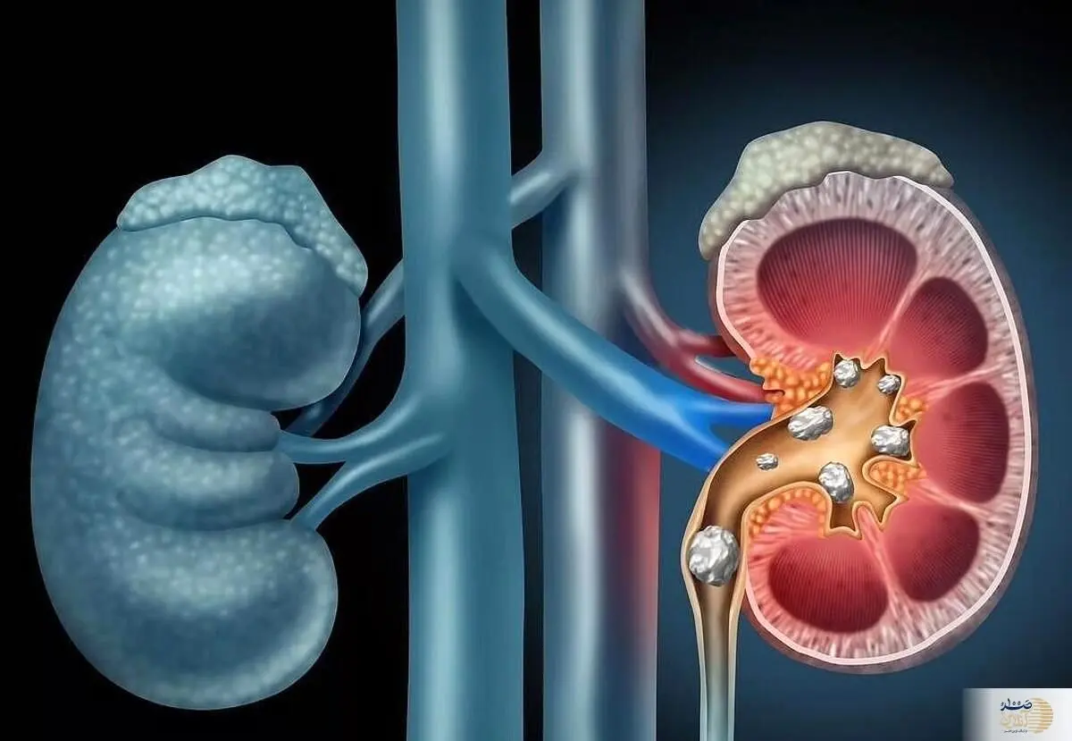 عضو حیاتی بدن شما بدون علامت از کار می افتد