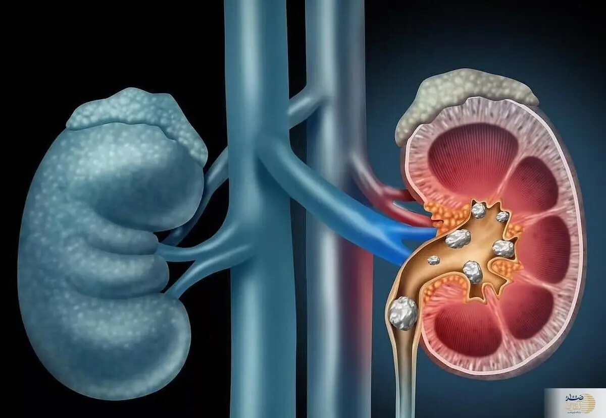 عضو حیاتی بدن شما بدون علامت از کار می افتد