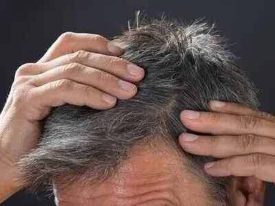 عارضه‌های زیاده روی در رنگ کردن مو