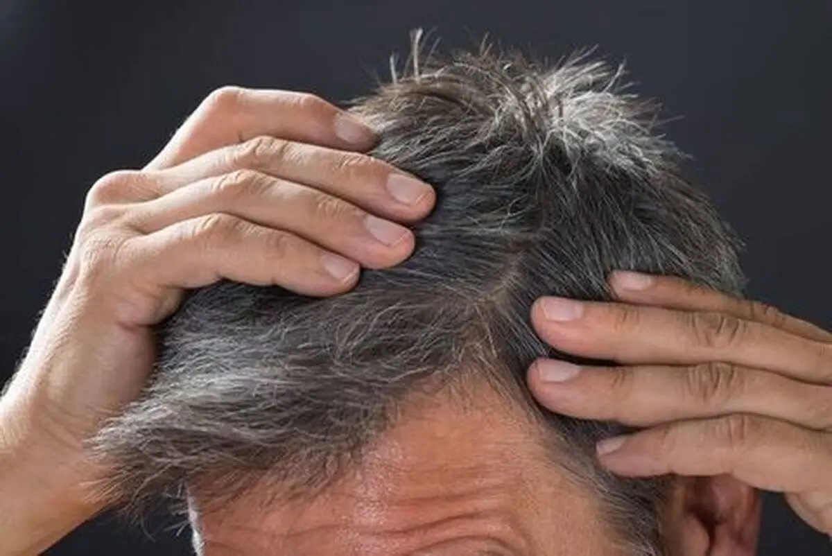 عارضه‌های زیاده روی در رنگ کردن مو
