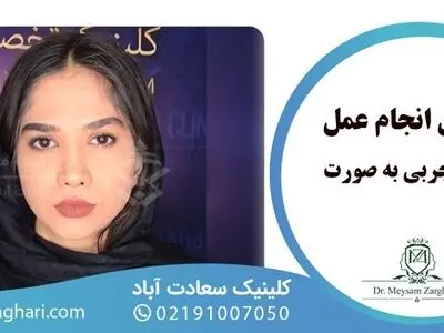 تزریق چربی به صورت در کلینیک دکتر لاغری با ماندگاری بالا