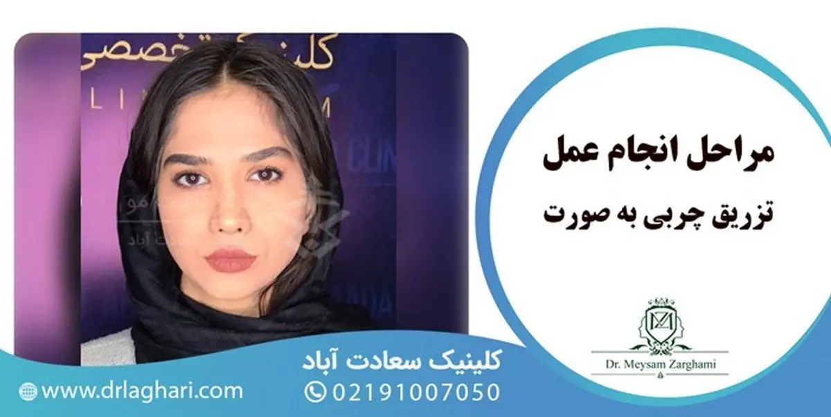 تزریق چربی به صورت در کلینیک دکتر لاغری با ماندگاری بالا