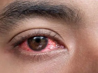 ۲۰ ثانیه استراحت برای چشم‌ها؛ بعد از هر ۲۰ دقیقه کار با دستگاه‌های دیجیتال ضروری است