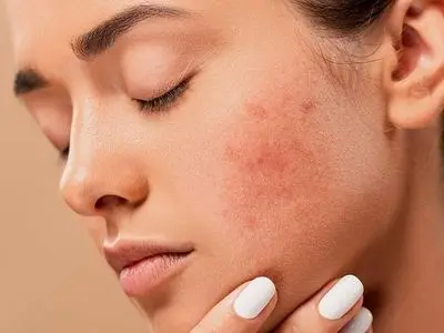 نشانه‌ های پوستی که خبر از بیماری جدی می‌دهند