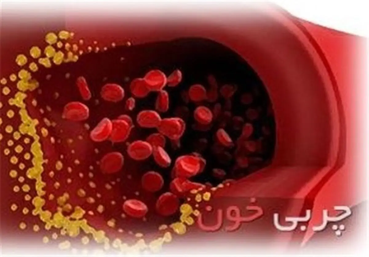 50 درصد مردم استان مرکزی مبتلا به چربی خون هستند 
