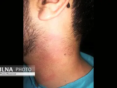 پرونده پرستاری که مورد ضرب و شتم قرار گرفت باید با قاطعیت دنبال شود/ تدوینِ  «منشور اخلاق حرفه‌ای» ضروری‌ست