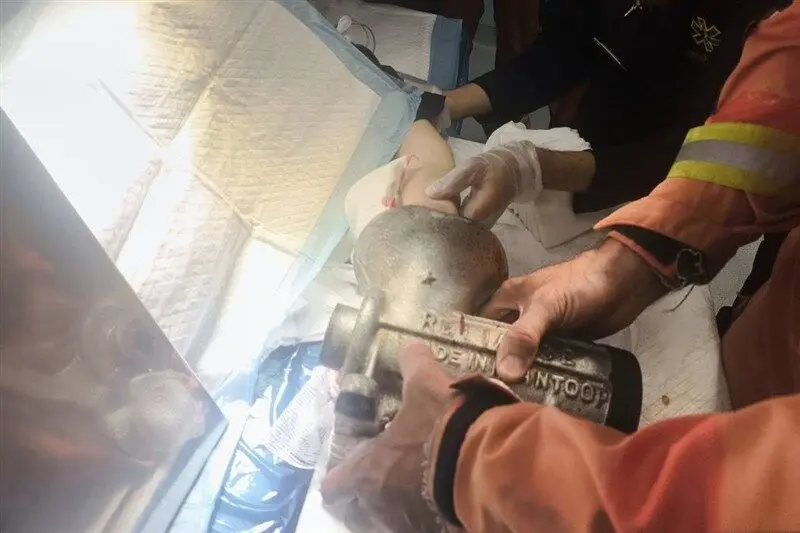دست زن کارگر ۴۸ ساله در چرخ‌گوشت گیر کرد/ مصدومیت شدید