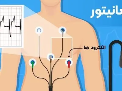باید ها و نباید ها در زمان استفاده از هولتر قلب
