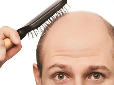 ۸ باور اشتباه درباره ریزش مو که باید فراموش کنید
