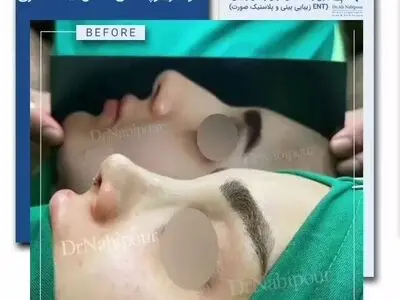 چقدر در رابطه با حقایق جراحی بینی اطلاعات دارید؟