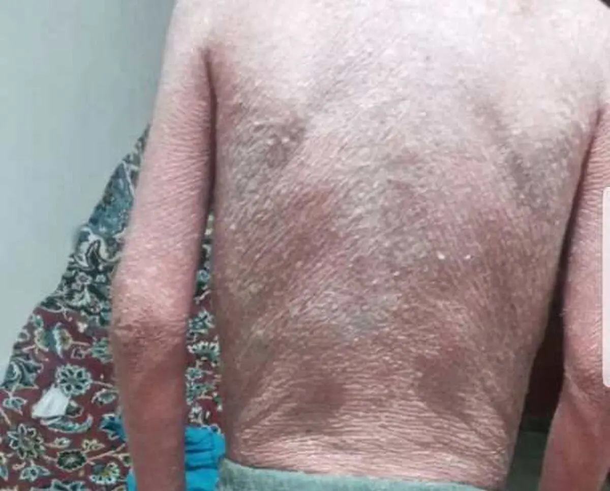درمان پسرانم را به خاطر  نداشتن پول قطع کردم/ مصرف هفتگی هر  بسته قرص فرزندانم 700 هزار تومان است / وخیم شدن وضعیت بچه‌ها پس از قطع داروها