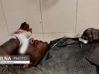 نوجوان ۱۵ ساله با انفجار نارنجک دستی، مصدوم شد